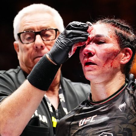 Irene Aldana shows miraculous recovery from extensive UFC 306 facial injuries